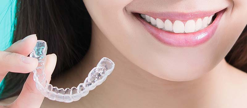 台中隱適美| 跟鋼牙妹說掰掰！隱形矯正炫風來襲！